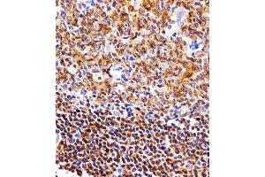 Immunohistochemistry (Paraffin-embedded Sections) (IHC (p)) image for anti-Nuclear Factor of kappa Light Polypeptide Gene Enhancer in B-Cells 1 (NFKB1) antibody (ABIN1882050)