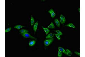 Immunofluorescent analysis of Hela cells using ABIN7158780 at dilution of 1:100 and Alexa Fluor 488-congugated AffiniPure Goat Anti-Rabbit IgG(H+L) (CTSA Antikörper  (AA 30-327))