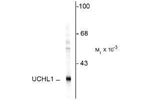 Western blot of rat hippocampal homogenate showing specific immunolabeling of the ~ 24k UCHL1 protein.