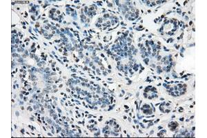 Immunohistochemical staining of paraffin-embedded breast tissue using anti-IDH1 mouse monoclonal antibody.