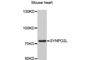 Western blot analysis of extracts of mouse heart, using SYNPO2L antibody (ABIN1875591) at 1:3000 dilution.