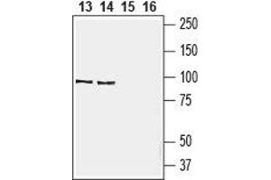 Western blot analysis of rat (lanes 13and 15)  and mouse (lanes 14 and 16) spleen lysate:13, 14.