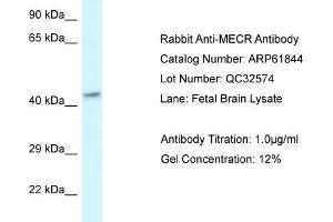 Western Blotting (WB) image for anti-Mitochondrial Trans-2-Enoyl-CoA Reductase (MECR) (C-Term) antibody (ABIN2788923) (MECR Antikörper  (C-Term))