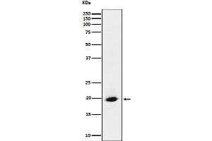 Western blot analysis of SRP19 expression in HeLa cell lysate.