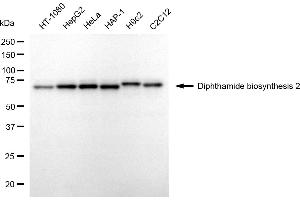 anti-Diphthamide Biosynthesis Protein 2 (DPH2) antibody