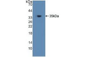 Western blot analysis of recombinant Human TRAF6. (TRAF6 Antikörper  (AA 153-423))
