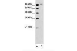 Image no. 2 for anti-rho-Related BTB Domain Containing 1 (RHOBTB1) (C-Term) antibody (ABIN6736347) (RHOBTB1 Antikörper  (C-Term))