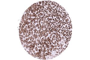 Strong StAR staining of normal adrenocortical cells (Rekombinanter STAR Antikörper)