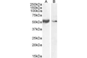 Western Blotting (WB) image for anti-Solute Carrier Family 7, (Cationic Amino Acid Transporter, Y+ System) Member 11 (SLC7A11) (Internal Region) antibody (ABIN190899)