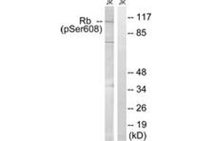 Western blot analysis of extracts from Jurkat cells treated with PMA 125ng/ml 30', using Retinoblastoma (Phospho-Ser608) Antibody. (Retinoblastoma Protein (Rb) Antikörper  (pSer608))