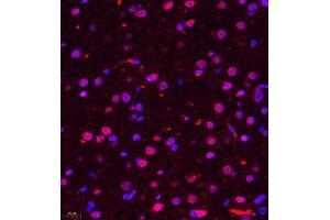 Immunofluorescence of paraffin embedded rat brain using ALS2CR13 (ABIN7073909) at dilution of 1:650 (400x lens) (FAM117B Antikörper)