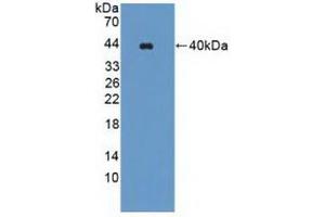 Detection of Recombinant WNK1, Human using Polyclonal Antibody to WNK Lysine Deficient Protein Kinase 1 (WNK1) (WNK1 Antikörper  (AA 1954-2231))