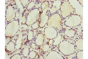 Immunohistochemistry of paraffin-embedded human thyroid tissue using ABIN7147407 at dilution of 1:100 (CEP44 Antikörper  (AA 1-280))