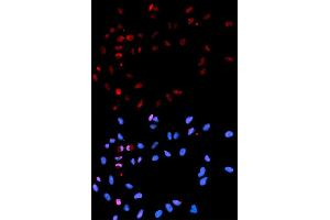 Immunofluorescence analysis of U2OS cells using Phospho-H2AFX-S139 antibody (ABIN5969940). (H2AFX Antikörper  (pSer139))