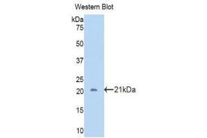 Western Blotting (WB) image for anti-Carbonic Anhydrase 12 (CA12) (AA 161-318) antibody (ABIN3204699) (CA12 Antikörper  (AA 161-318))