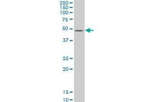 ZIC3 monoclonal antibody (M05), clone 2C1. (ZIC3 Antikörper  (AA 182-274))