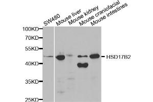 Western blot analysis of extracts of various cell lines, using HSD17B2 antibody. (HSD17B2 Antikörper)