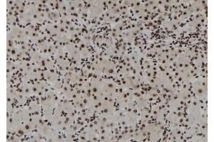 ABIN6261294 and ABIN6273109 at 1/100 staining Human liver tissue by IHC-P. (DHX38 Antikörper  (C-Term))