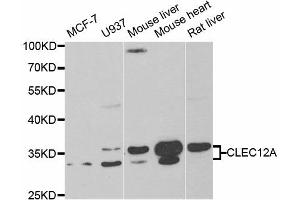 Western Blotting (WB) image for anti-C-Type Lectin Domain Family 12, Member A (CLEC12A) antibody (ABIN1882376) (CLEC12A Antikörper)