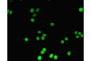 Immunofluorescent analysis of PC-3 cells using ABIN7150213 at dilution of 1:100 and Alexa Fluor 488-congugated AffiniPure Goat Anti-Rabbit IgG(H+L) (TdT Antikörper  (AA 1-509))