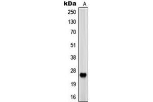 Western blot analysis of EOS expression in HEK293 (A) whole cell lysates. (Eosinophilia, Familial Antikörper  (Center))