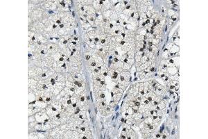IHC analysis of LSM2 using anti-LSM2 antibody (ABIN7602832).