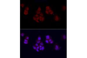 Immunofluorescence analysis of MCF7 cells using MonoMethyl-Histone H3-K27 Rabbit pAb (ABIN3023262, ABIN3023263, ABIN3023264, ABIN1513004 and ABIN6219518) at dilution of 1:50 (40x lens).