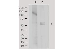 Western blot analysis of extracts from Hela, using TINF2 Antibody. (TINF2 Antikörper  (Internal Region))