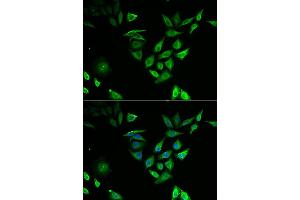 Immunofluorescence analysis of U2OS cell using NUTF2 antibody. (NUTF2 Antikörper)