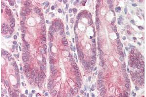 Image no. 2 for anti-Signal Transducing Adaptor Family Member 2 (STAP2) (AA 437-449) antibody (ABIN1492826) (STAP2 Antikörper  (AA 437-449))