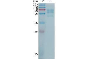 Human C Protein, His Tag on SDS-PAGE under reducing condition.