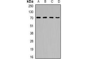 Western blot analysis of CNDP1 expression in A431 (A), HepG2 (B), mouse kidney (C), rat brain (D) whole cell lysates. (CNDP1 Antikörper)