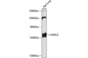 Western blot analysis of extracts of rat lung, using L antibody (ABIN6128174, ABIN6143076, ABIN6143077 and ABIN6219002) at 1:1000 dilution. (LAMC2 Antikörper  (AA 862-1111))