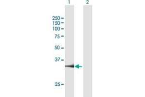 Western Blot analysis of PARP16 expression in transfected 293T cell line by PARP16 MaxPab polyclonal antibody. (PARP16 Antikörper  (AA 1-323))