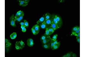 Immunofluorescence staining of HepG2 cells with ABIN7163188 at 1:133, counter-stained with DAPI. (PIK3CA Antikörper  (Catalytic Subunit alpha))