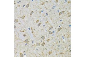 Immunohistochemistry of paraffin-embedded mouse brain using DHRS2 antibody (ABIN5973846) at dilution of 1/100 (40x lens). (DHRS2 Antikörper)
