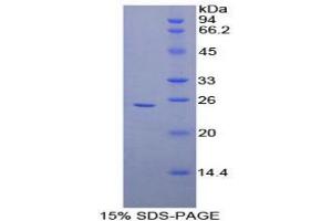 SDS-PAGE analysis of Human Coronin 1A Protein. (Coronin 1a Protein)