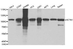Western blot analysis of extracts of various cell lines, using ACTN1 antibody. (ACTN1 Antikörper  (AA 1-330))