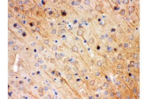 Anti- KCNIP2 Picoband antibody,IHC(P) IHC(P): Mouse Brain Tissue (KCNIP2 Antikörper  (N-Term))