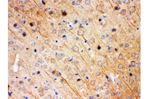 Anti- KCNIP2 Picoband antibody,IHC(P) IHC(P): Mouse Brain Tissue