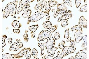 IHC analysis of Cyclophilin E/PPIE using anti-Cyclophilin E/PPIE antibody (ABIN7599242). (PPIE Antikörper  (AA 1-301))