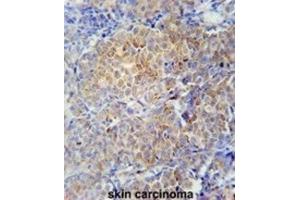 Immunohistochemistry (IHC) image for anti-Serpin Family H Member 1 (SERPINH1) antibody (ABIN2910986)