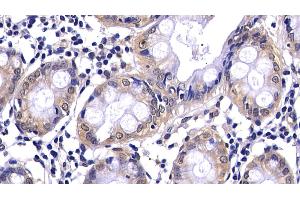 Detection of CASP2 in Human Colon Tissue using Polyclonal Antibody to Caspase 2 (CASP2)
