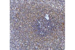 IHC analysis of CAD using anti-CAD antibody (ABIN7600044).