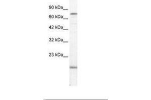 Image no. 1 for anti-PiggyBac Transposable Element Derived 3 (PGBD3) (AA 52-101) antibody (ABIN202794) (PGBD3 Antikörper  (AA 52-101))