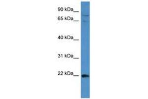 Image no. 1 for anti-Mitogen-Activated Protein Kinase Kinase Kinase 15 (MAP3K15) (AA 1201-1250) antibody (ABIN6743478) (MAP3K15 Antikörper  (AA 1201-1250))