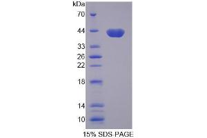 SDS-PAGE (SDS) image for Aquaporin 8 (AQP8) (AA 129-228) protein (His tag,GST tag) (ABIN6236952)
