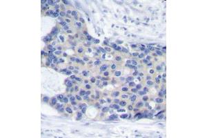 Immunohistochemistry (IHC) image for anti-zeta-Chain (TCR) Associated Protein Kinase 70kDa (ZAP70) (pTyr493) antibody (ABIN3020535) (ZAP70 Antikörper  (pTyr493))