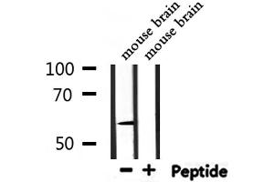 Western blot analysis of extracts from mouse brain, using UGT1A9  Antibody. (UGT1A9 Antikörper  (C-Term))