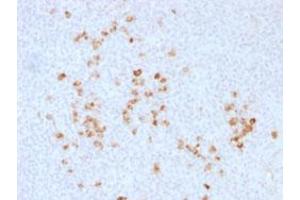 Immunohistochemical staining (Formalin-fixed paraffin-embedded sections) of human tonsil with IgG (Heavy Chain) polyclonal antibody . (Kaninchen anti-Human Immunoglobulin Heavy Constant gamma 1 (G1m Marker) (IGHG1) (Heavy Chain) Antikörper)